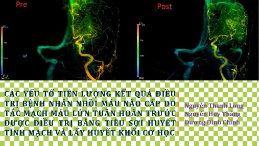 Bài giảng Các yếu tố tiên lượng kết quả điều trị bệnh nhân nhồi máu não cấp do tắc mạch máu lớn tuần hoàn trước được điều trị bằng tiêu sợi huyết tĩnh mạch và lấy huyết khối cơ học
