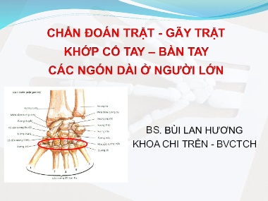 Bài giảng Chuẩn đoán trật - Gãy trật khớp cổ tay - Bàn tay các ngón dài ở người lớn
