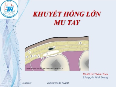 Bài giảng Khuyết hổng lớn mu tay